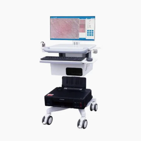 Electronic Dermatoscope